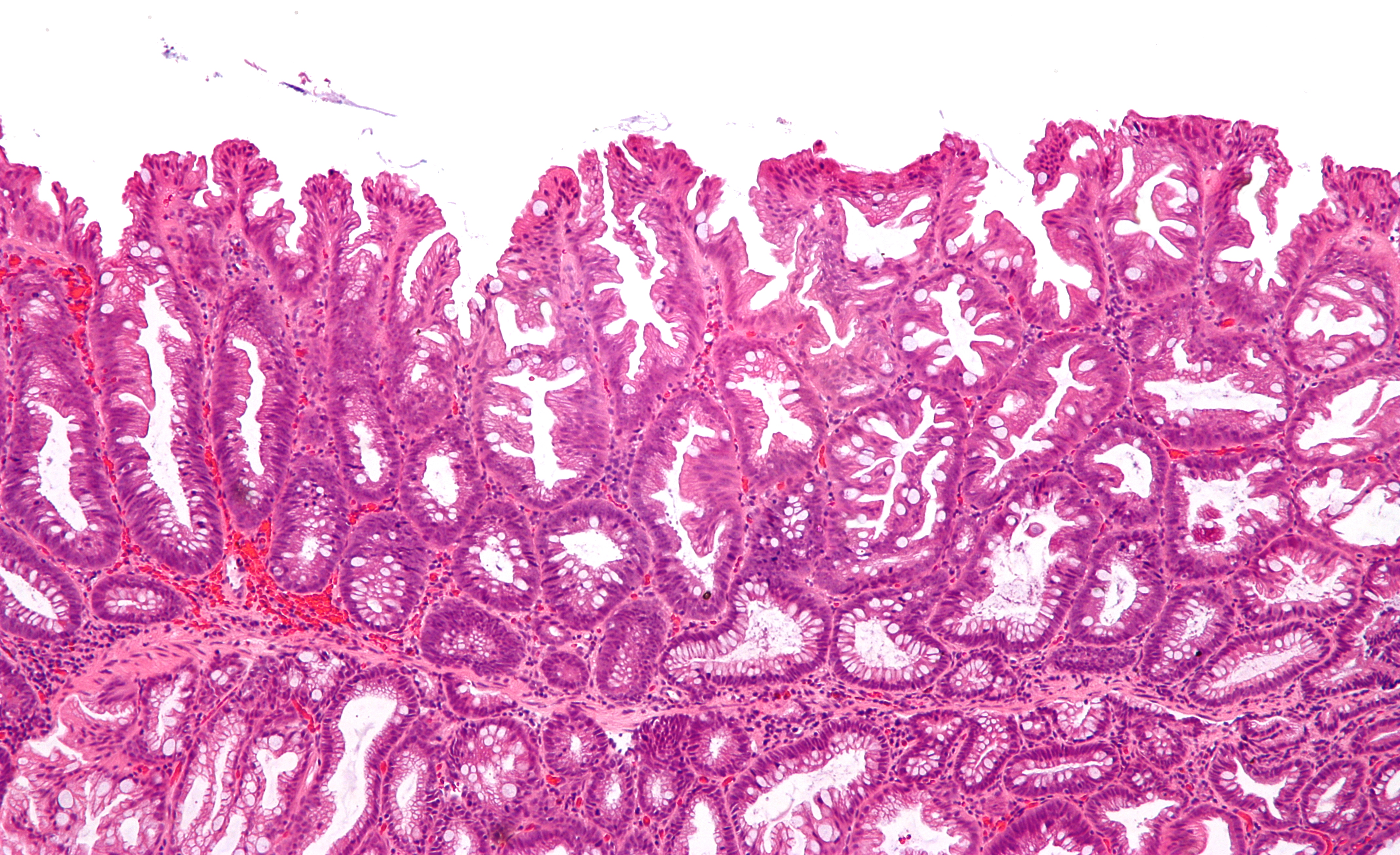 SSA image